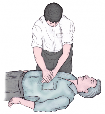 Cardiopulmonary Resuscitation (CPR): Practice Essentials ...