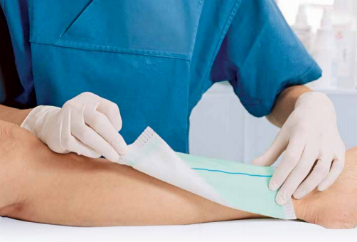When to Use Modern Wound Care Products - Advanced Tissue